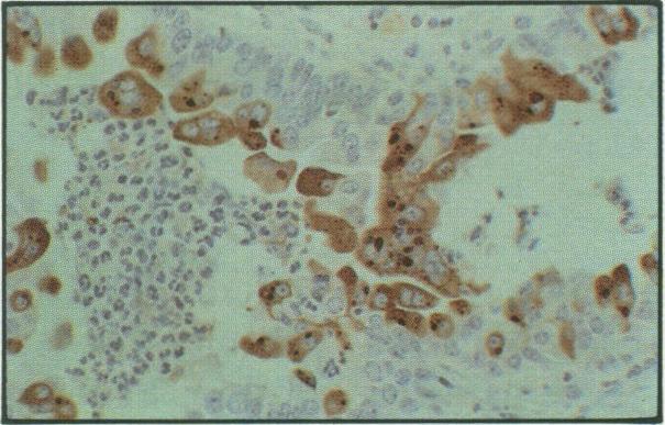 https://cdn.ncbi.nlm.nih.gov/pmc/blobs/fc2c/1481497/176d337fed9a/canvetj00066-0042-d.jpg