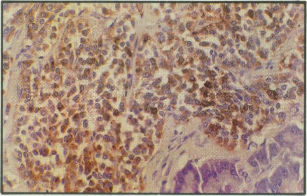 https://cdn.ncbi.nlm.nih.gov/pmc/blobs/fc2c/1481497/41fee51629cd/canvetj00066-0043-l.jpg