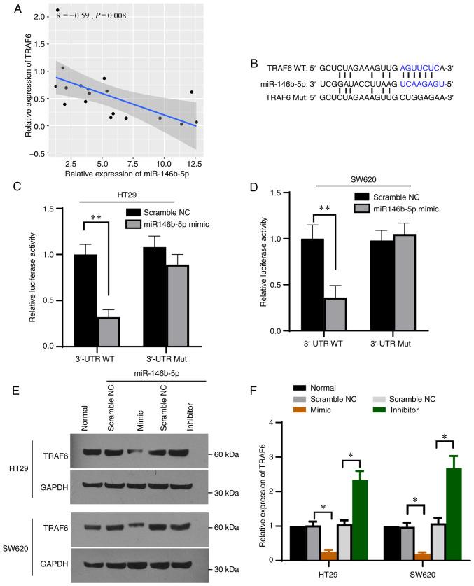 https://cdn.ncbi.nlm.nih.gov/pmc/blobs/fc34/8815033/13cdcad480c4/etm-23-03-11155-g03.jpg