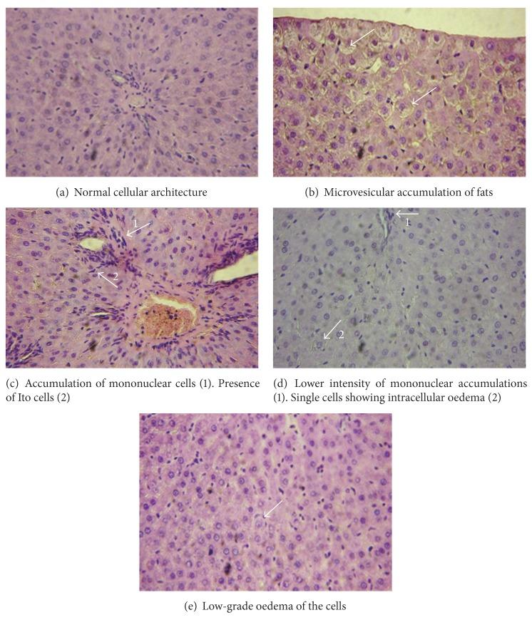 https://cdn.ncbi.nlm.nih.gov/pmc/blobs/fc36/3708395/b33fc8cacc2b/BMRI2013-757126.003.jpg
