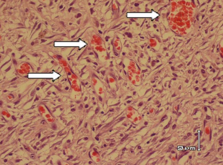 https://cdn.ncbi.nlm.nih.gov/pmc/blobs/fc38/4298861/a5eb8401c73a/wjps-4-023-g003.jpg