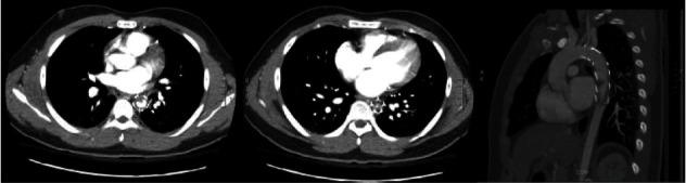 https://cdn.ncbi.nlm.nih.gov/pmc/blobs/fc3a/8860563/9c1049ab0928/CRIVAM2022-5583120.001.jpg
