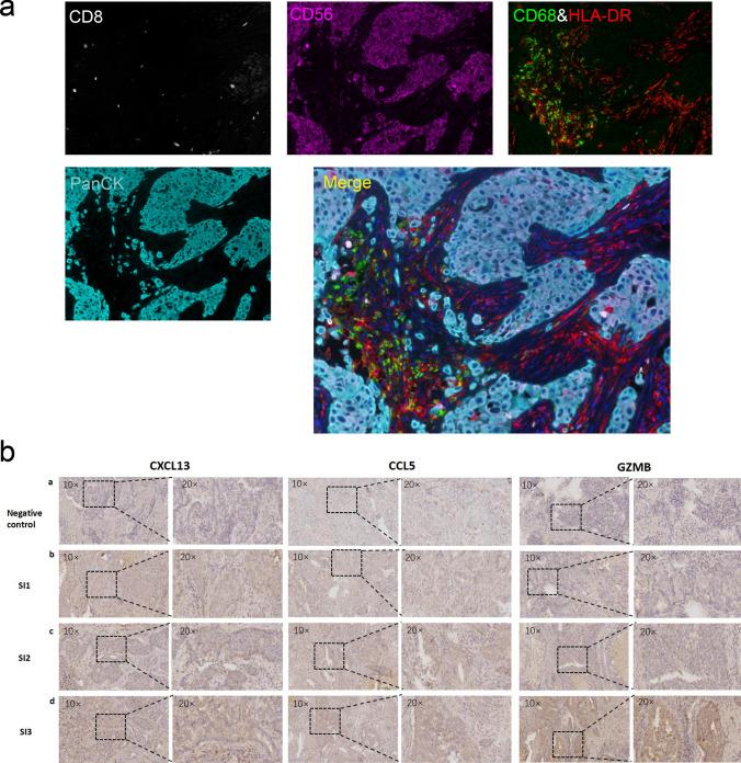 https://cdn.ncbi.nlm.nih.gov/pmc/blobs/fc3b/10618350/bc55e2372cf1/10238_2023_1090_Fig7_HTML.jpg
