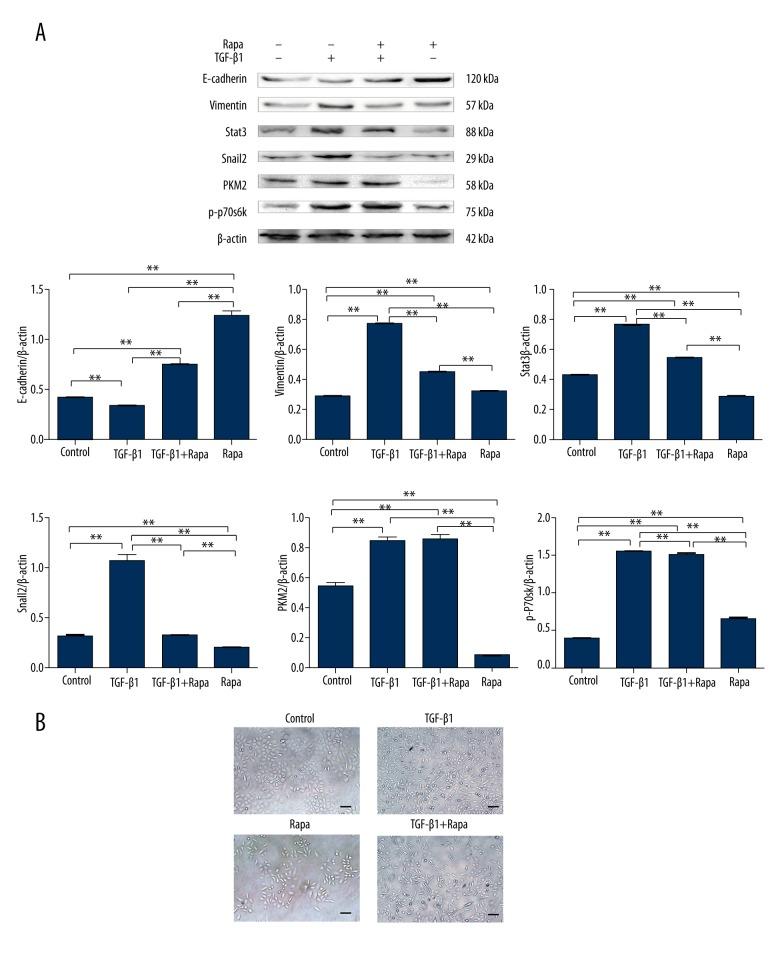 https://cdn.ncbi.nlm.nih.gov/pmc/blobs/fc3d/5417590/8b673f890513/medscimonit-23-2017-g008.jpg