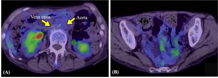 https://cdn.ncbi.nlm.nih.gov/pmc/blobs/fc3f/11908406/8f0650ff69aa/cureus-0017-00000078894-i03.jpg