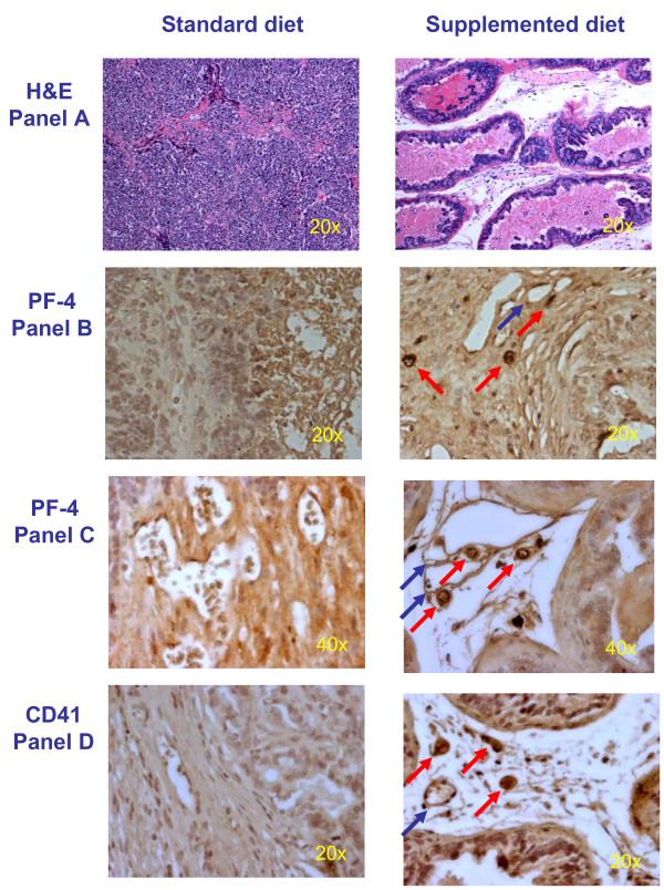 https://cdn.ncbi.nlm.nih.gov/pmc/blobs/fc43/2896361/76917ed3ae0c/1471-2407-10-258-3.jpg
