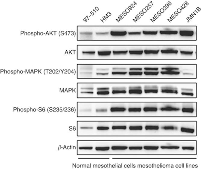 https://cdn.ncbi.nlm.nih.gov/pmc/blobs/fc44/4021537/2022e2f7ab10/bjc2014220f1.jpg