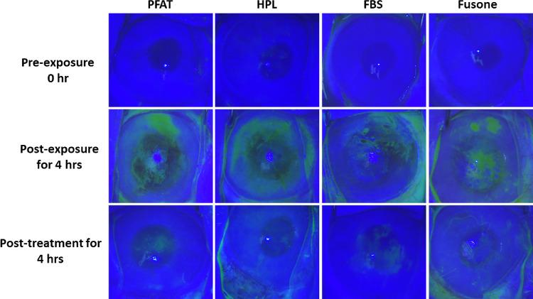 https://cdn.ncbi.nlm.nih.gov/pmc/blobs/fc45/12204233/eafb7a559a71/iovs-66-6-73-f001.jpg