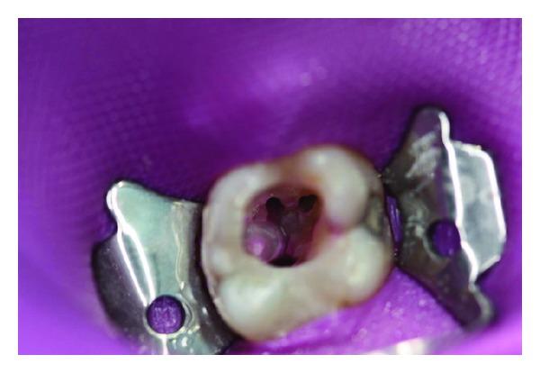 https://cdn.ncbi.nlm.nih.gov/pmc/blobs/fc4a/3518957/fdc8efe74b25/CRIM.DENTISTRY2012-453415.003.jpg