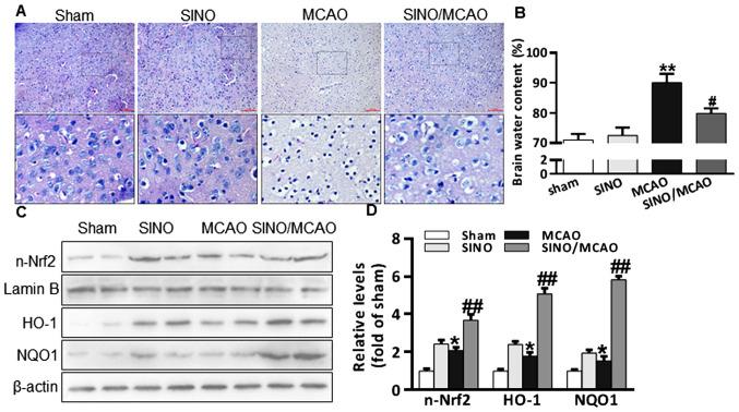 https://cdn.ncbi.nlm.nih.gov/pmc/blobs/fc4c/8097210/d6dfd0be60b9/etm-21-06-10079-g00.jpg