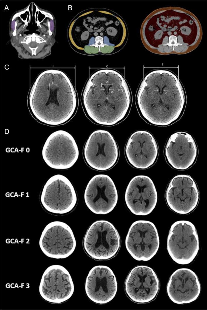 https://cdn.ncbi.nlm.nih.gov/pmc/blobs/fc55/8722183/63ec48094e1a/12877_2021_2626_Fig1_HTML.jpg