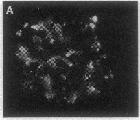 https://cdn.ncbi.nlm.nih.gov/pmc/blobs/fc56/53116/4c4384944466/pnas01074-0303-a.jpg