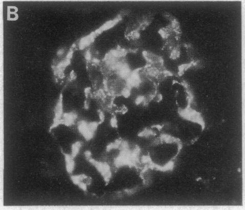 https://cdn.ncbi.nlm.nih.gov/pmc/blobs/fc56/53116/faf6aa108321/pnas01074-0303-c.jpg