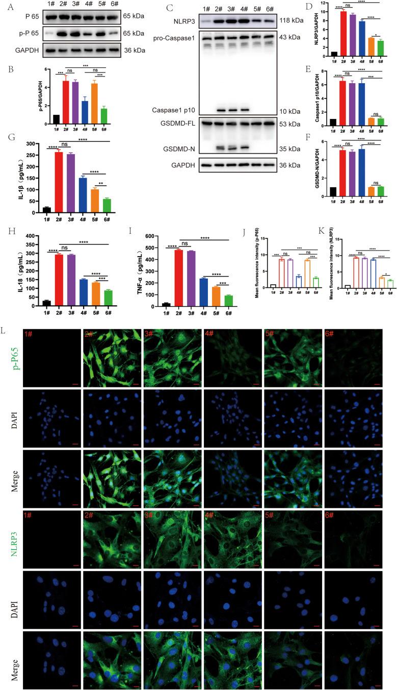https://cdn.ncbi.nlm.nih.gov/pmc/blobs/fc5a/10929269/020d882dd55f/IJN-19-2179-g0006.jpg