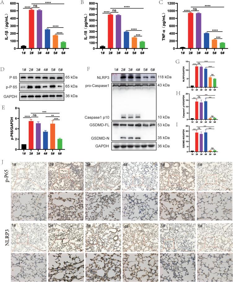 https://cdn.ncbi.nlm.nih.gov/pmc/blobs/fc5a/10929269/90371c352c67/IJN-19-2179-g0008.jpg