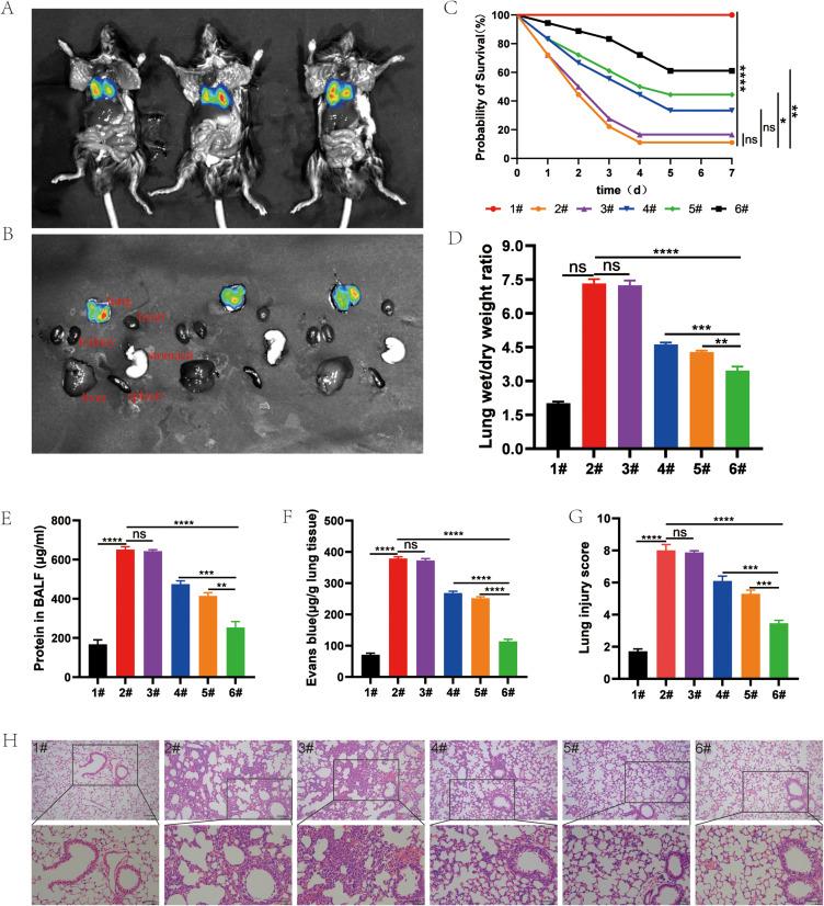https://cdn.ncbi.nlm.nih.gov/pmc/blobs/fc5a/10929269/bffff43759cd/IJN-19-2179-g0007.jpg