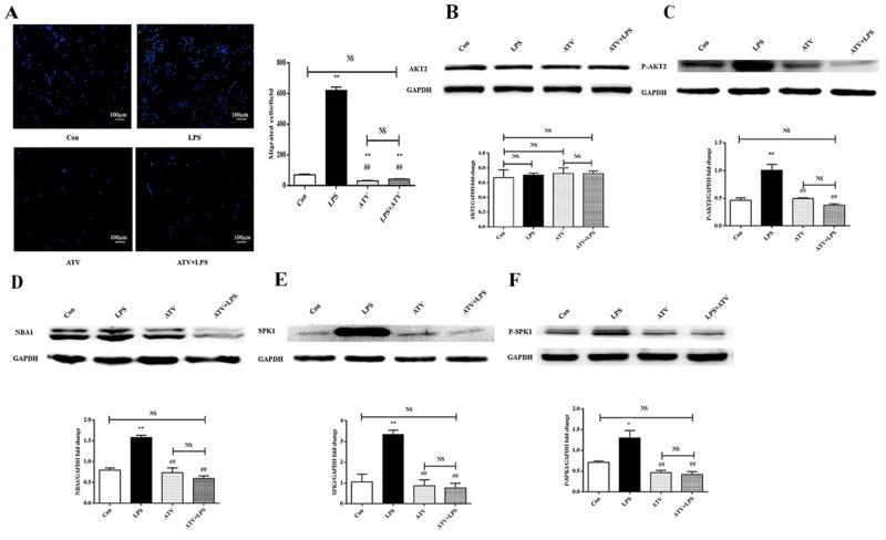 https://cdn.ncbi.nlm.nih.gov/pmc/blobs/fc5a/5777776/43c5f22635c8/oncotarget-08-115345-g006.jpg