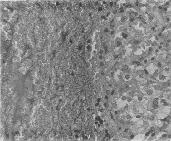 https://cdn.ncbi.nlm.nih.gov/pmc/blobs/fc5d/1344300/d8cd61b7cc84/annsurg00269-0042-a.jpg