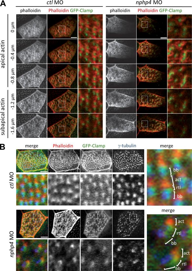 https://cdn.ncbi.nlm.nih.gov/pmc/blobs/fc5f/4674276/eb3e6d08e023/JCB_201502043_Fig3.jpg