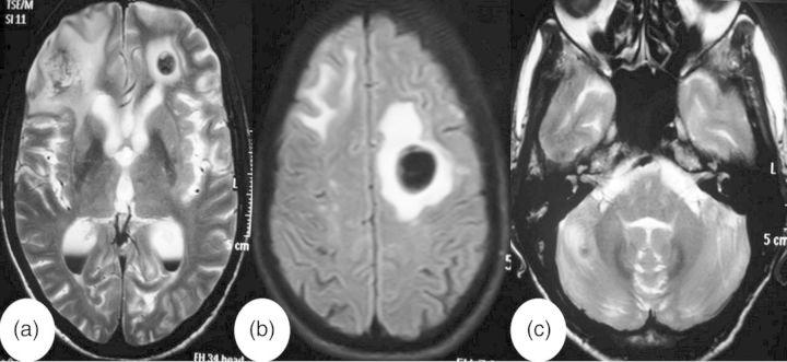 https://cdn.ncbi.nlm.nih.gov/pmc/blobs/fc61/4370008/f18e7fb851c8/omv01102.jpg