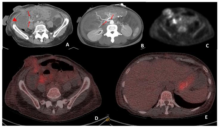 https://cdn.ncbi.nlm.nih.gov/pmc/blobs/fc67/10301565/69655fb653dc/jimaging-09-00114-g005.jpg
