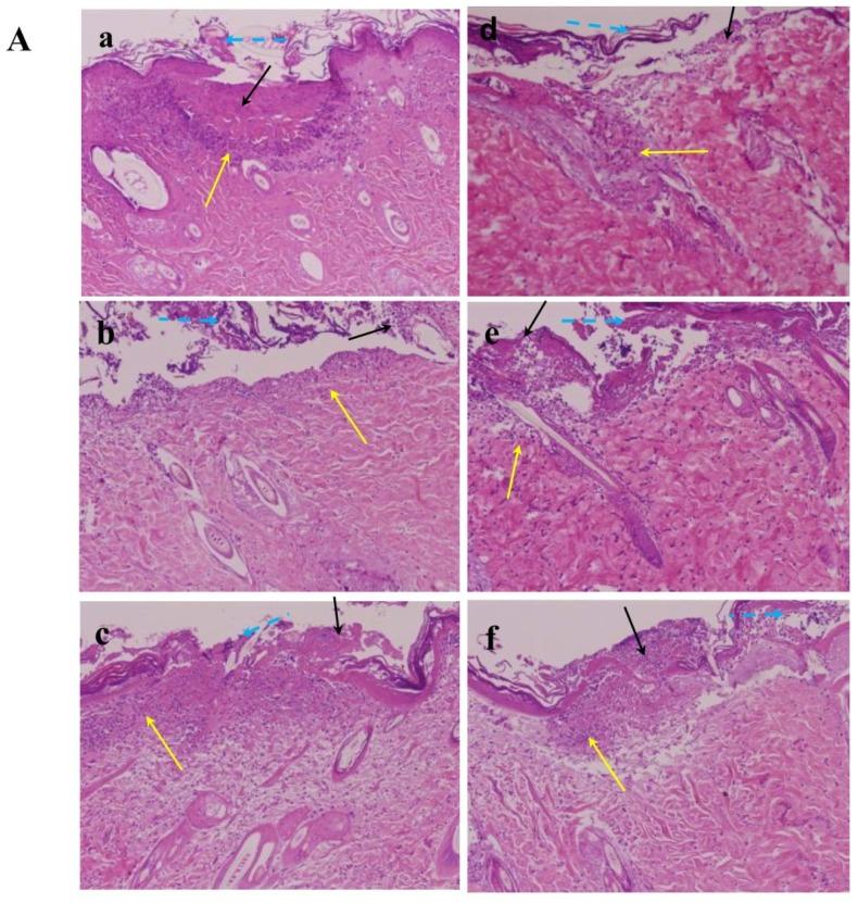 https://cdn.ncbi.nlm.nih.gov/pmc/blobs/fc68/4057691/a331dcb33d25/ijms-15-07563f6a.jpg