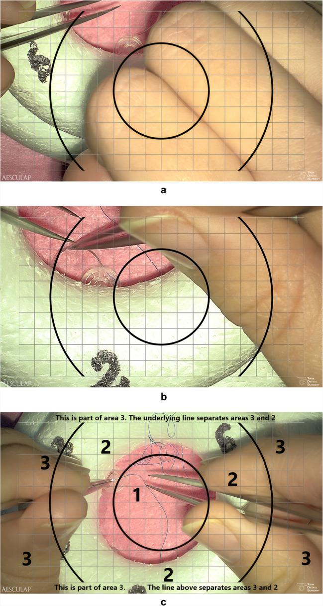 https://cdn.ncbi.nlm.nih.gov/pmc/blobs/fc69/12202507/680308f81ad2/701_2025_6589_Fig2_HTML.jpg