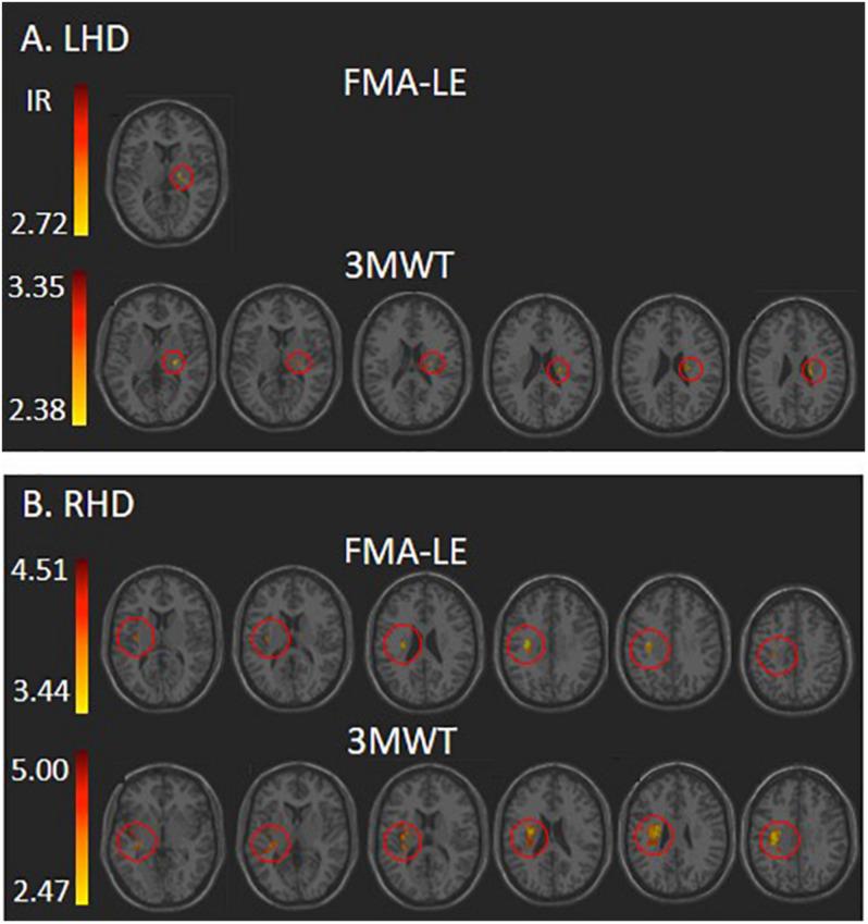 https://cdn.ncbi.nlm.nih.gov/pmc/blobs/fc6a/7882502/4db2bc4c1a27/fnhum-15-592975-g002.jpg