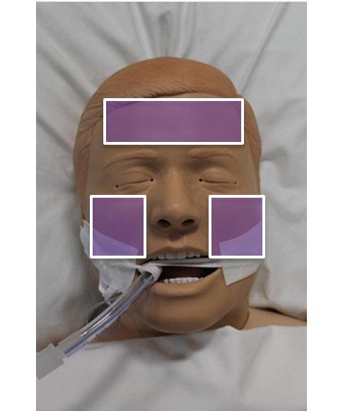 https://cdn.ncbi.nlm.nih.gov/pmc/blobs/fc6c/12165443/9e4ba2829a56/formative-v9-e60455-g002.jpg