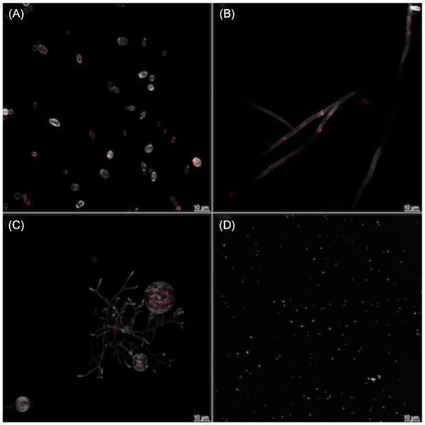 https://cdn.ncbi.nlm.nih.gov/pmc/blobs/fc75/10117802/7e2b35d741bf/xtab019fig2.jpg