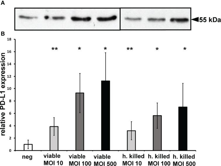 https://cdn.ncbi.nlm.nih.gov/pmc/blobs/fc78/9277116/0419b3db0da9/fcimb-12-935806-g001.jpg
