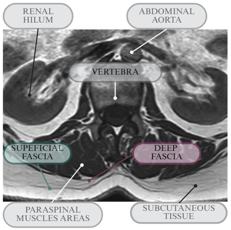 https://cdn.ncbi.nlm.nih.gov/pmc/blobs/fc84/12385576/32b232618b90/diagnostics-15-02059-g002.jpg