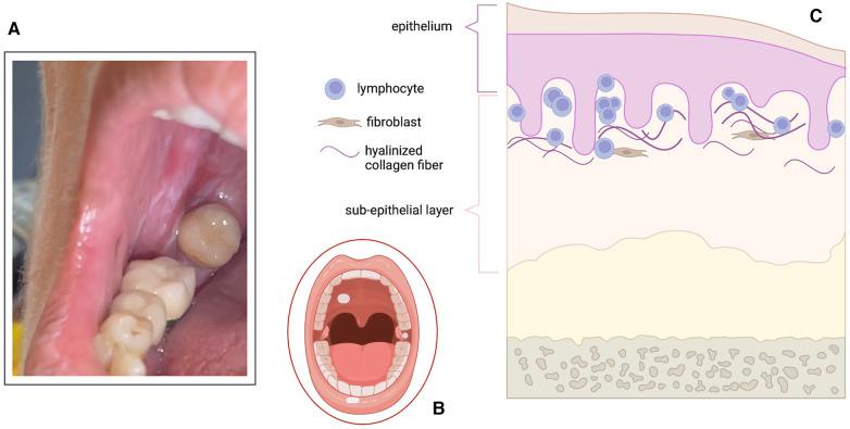 https://cdn.ncbi.nlm.nih.gov/pmc/blobs/fc8c/11251963/78122b9c8057/froh-05-1428008-g001.jpg