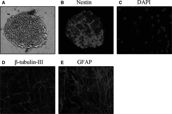https://cdn.ncbi.nlm.nih.gov/pmc/blobs/fc8d/5571550/0e367d736782/JCMM-21-2163-g001.jpg