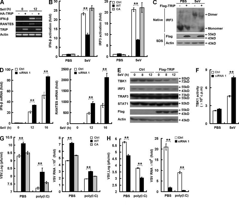 https://cdn.ncbi.nlm.nih.gov/pmc/blobs/fc93/3457734/7fc3cd1be322/JEM_20120024_Fig5.jpg