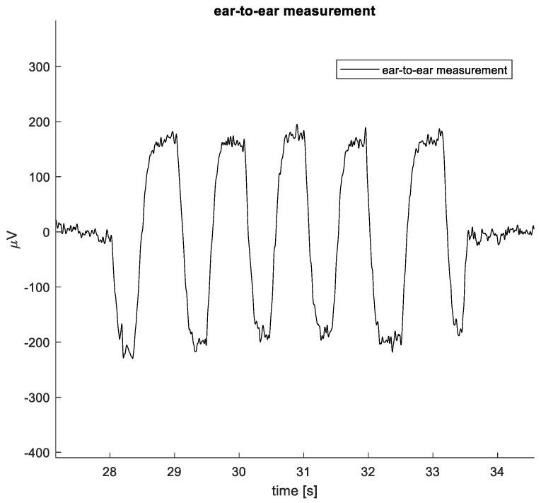 https://cdn.ncbi.nlm.nih.gov/pmc/blobs/fc95/10819754/1b41cb81b005/sensors-24-00420-g009.jpg