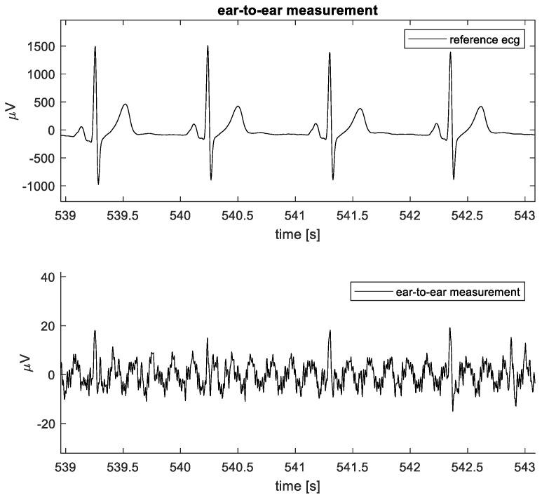 https://cdn.ncbi.nlm.nih.gov/pmc/blobs/fc95/10819754/85b5e173bf5d/sensors-24-00420-g008.jpg