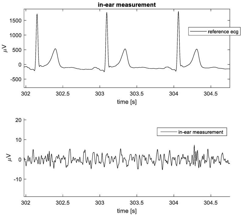 https://cdn.ncbi.nlm.nih.gov/pmc/blobs/fc95/10819754/a7b9510a91e4/sensors-24-00420-g010.jpg