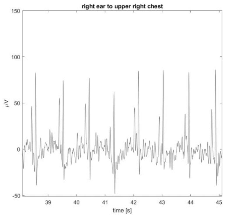 https://cdn.ncbi.nlm.nih.gov/pmc/blobs/fc95/10819754/c4a18736ec16/sensors-24-00420-g011.jpg