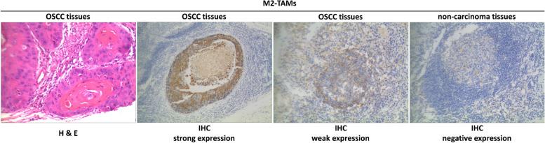 https://cdn.ncbi.nlm.nih.gov/pmc/blobs/fca1/11055382/0b7a98b5a17b/12885_2024_12300_Fig6_HTML.jpg