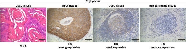 https://cdn.ncbi.nlm.nih.gov/pmc/blobs/fca1/11055382/95f02f60bcc1/12885_2024_12300_Fig4_HTML.jpg