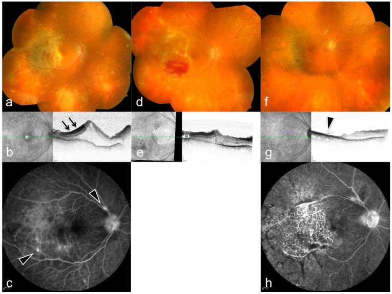 https://cdn.ncbi.nlm.nih.gov/pmc/blobs/fca2/8871417/147b0ac0c165/diagnostics-12-00386-g003.jpg