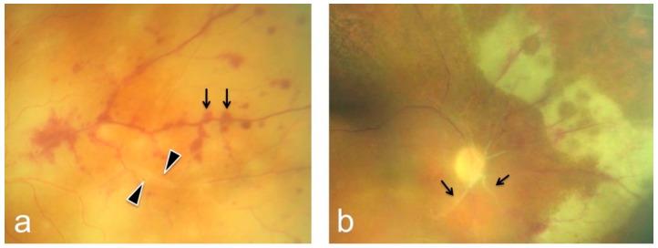https://cdn.ncbi.nlm.nih.gov/pmc/blobs/fca2/8871417/18db40d6a4be/diagnostics-12-00386-g001.jpg