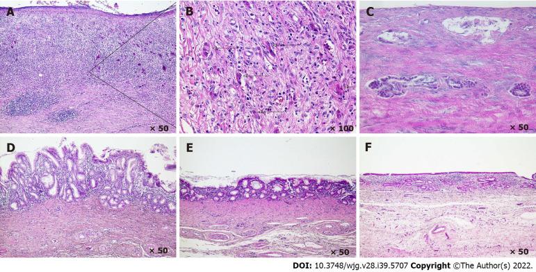 https://cdn.ncbi.nlm.nih.gov/pmc/blobs/fca3/9627420/07771497fc84/WJG-28-5707-g002.jpg