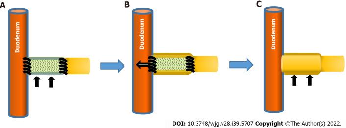 https://cdn.ncbi.nlm.nih.gov/pmc/blobs/fca3/9627420/2f2fa9594c5c/WJG-28-5707-g004.jpg