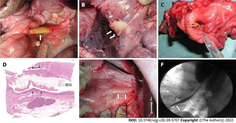 https://cdn.ncbi.nlm.nih.gov/pmc/blobs/fca3/9627420/b74ea0a69d9f/WJG-28-5707-g003.jpg