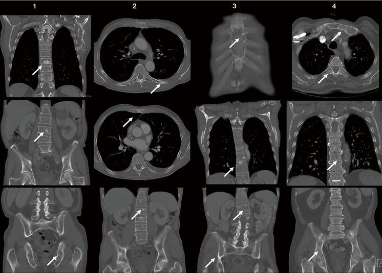 https://cdn.ncbi.nlm.nih.gov/pmc/blobs/fca6/11558497/0b767683626a/qims-14-11-7872-f7.jpg
