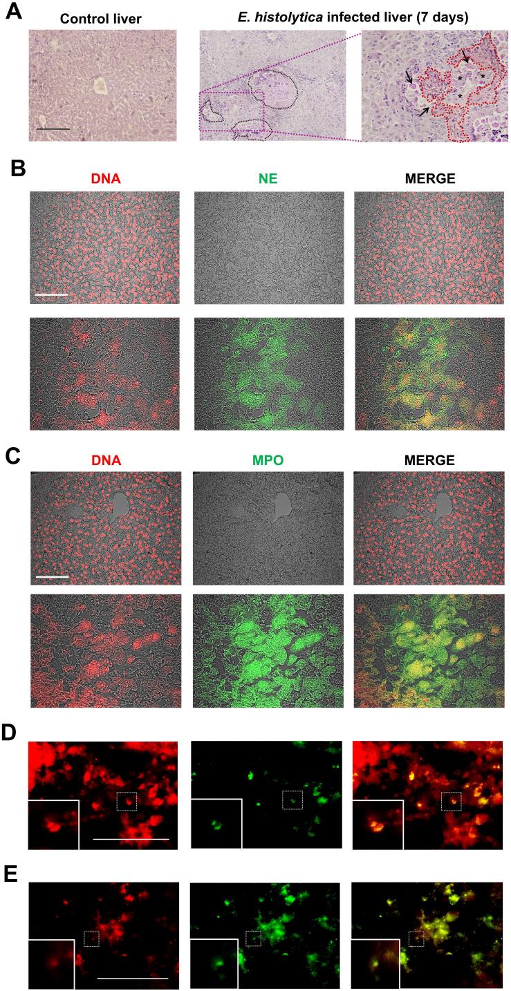 https://cdn.ncbi.nlm.nih.gov/pmc/blobs/fca6/11646992/08839a5d93eb/fimmu-15-1493946-g001.jpg