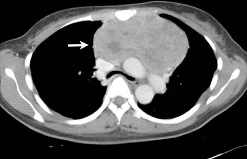 https://cdn.ncbi.nlm.nih.gov/pmc/blobs/fca7/4602428/a086d3b7d84d/medi-93-e42-g005.jpg