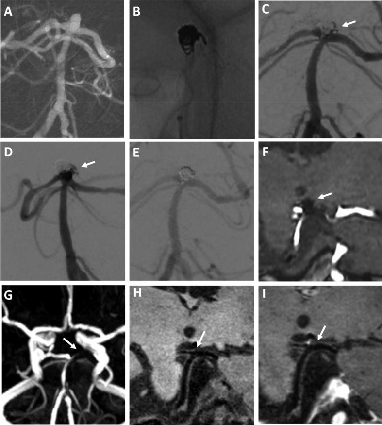 https://cdn.ncbi.nlm.nih.gov/pmc/blobs/fcaa/8562288/4b6ada2a2703/gr2.jpg